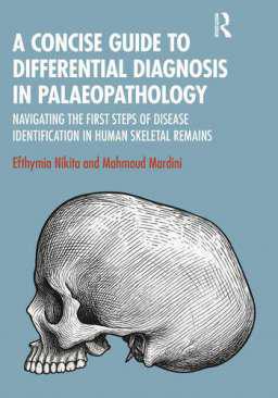 A Concise Guide to Differential Diagnosis in Palaeopathology
