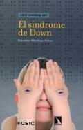 El sndrome de Down