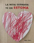 La meva germana t un estoma