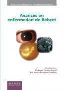 Avances en enfermedad de Behet