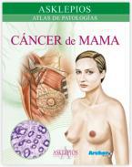 Atlas de cncer de mama