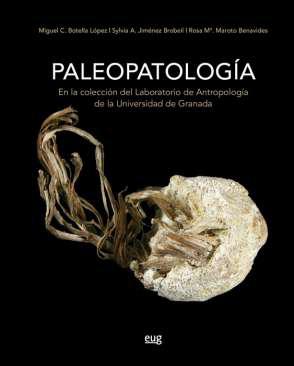 Paleopatologa en la coleccin del laboratorio de Antropologa de la Universidad de Granada
