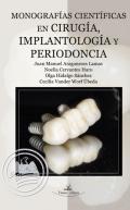 Monografas cientficas en ciruga, implantologa y periodoncia
