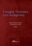 Ciruga tiroidea con imgenes