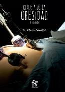 Ciruga de la obesidad