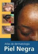 Atlas de dermatologa en piel negra