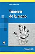 Tumores en la mano